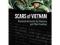 Scars of Vietnam: Personal Accounts by Veterans an