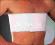 THUASNE - Pas piersiowo-brzuszny typu bandaż
