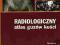 Radiologiczny atlas guzów kości U. Grzesiakowska