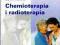 CHEMIOTERAPIA I RADIOTERAPIA [NOWA]