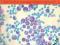 Współczesna diagnostyka leczenie chorób krwi - Maj