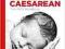 VAGINAL BIRTH AFTER CAESAREAN: THE VBAC HANDBOOK