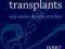 THE ETHICS OF TRANSPLANTS Janet Radcliffe Richards