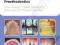 CLINICAL CASES IN PROSTHODONTICS (CLINICAL CASES)