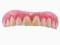 Sztuczne zęby - Hollywood Star (górna szczęka)