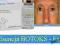 BOTOKS - mezoterapia derma roller laser SUPER CENA