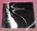 Grenzfrequenz - Grenzfrequenz    A848
