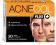 ACNECOL PLUS  30TABL. TRĄDZIK PRYSZCZE