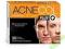 Acnecol plus+ 30tabletek Colfarm na cera, trądzik