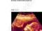 OBSTETRICS AND GYNAECOLOGY (LECTURE NOTES)