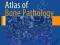 ATLAS OF BONE PATHOLOGY Shi Wei, Gene Siegal