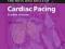 THE NUTS AND BOLTS OF CARDIAC PACING Tom Kenny