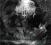 CHRIST AGONY NOCTURN DIGIPACK BEHEMOTH NOWA FOLIA