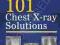 101 CHEST X-RAY SOLUTIONS Hariqbal Singh