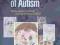 THE HIDDEN WORLD OF AUTISM Rebecca Chilvers