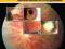 CLINICAL METHODS IN OPHTHALMOLOGY K. Dadapeer