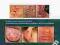 Dermatologia Rycroft, Robertson, Wakelin PZWL