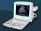 Aparat USG U50 ultrasonograf Color Power CWDoppler