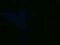 Stolik kawowy stolik nocny aluminiowy metalowy