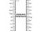 PCF8574 expander I2C PCF 8574 TS SSOP20 NXP