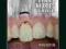 TRAUMATIC DENTAL INJURIES: A MANUAL Andreasen