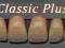 Zęby akrylowe 3-warstwowe - płytka 6 szt