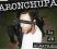 Aronchupa - I'm An Albatraoz NEW 2015 HIT