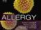ALLERGY: EXPERT CONSULT ONLINE AND PRINT Church